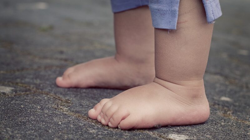 Les Pieds Plats : Impact et Solutions Orthopédiques