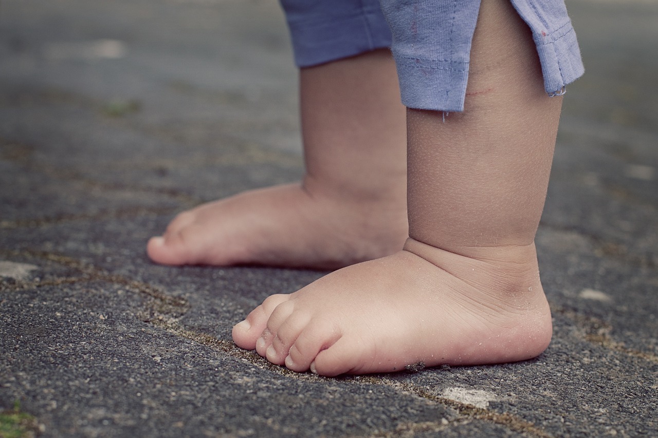 Les Pieds Plats : Impact et Solutions Orthopédiques